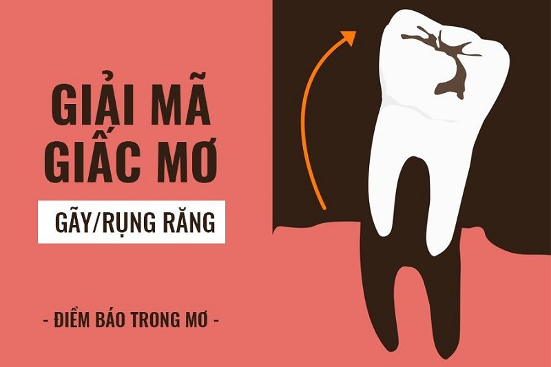 Gãy răng có ảnh hưởng gì? Gãy răng có xui không?